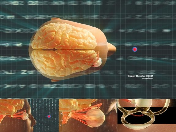 3D Medical Animation